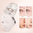 Aurora Skin — Máscara Facial LED Multicolor