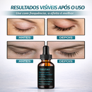Lash & Brow Serum — Crescimento de Cílios e Sobrancelhas