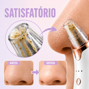 Skin Essence Pro™ – Removedor de Cravos a Vácuo com Limpeza Profunda Profissional