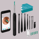 Limpador de Ouvido Otoscópio NE3 com Câmera Removedor de Cera Limpeza Wireless