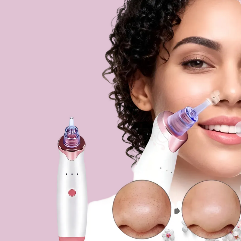 Skin Essence Pro™ – Removedor de Cravos a Vácuo com Limpeza Profunda Profissional